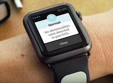 ECG là gì? ECG trên Apple Watch có gì đặc biệt? 
